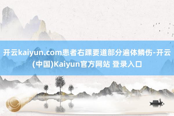 开云kaiyun.com患者右踝要道部分遍体鳞伤-开云(中国)Kaiyun官方网站 登录入口